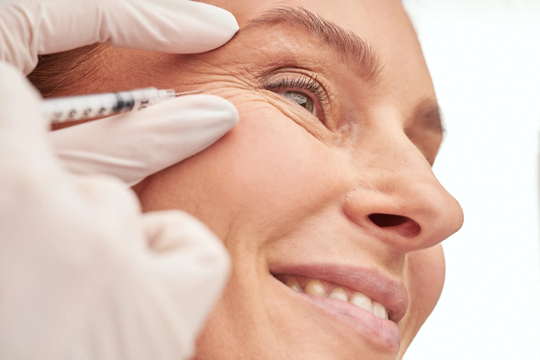 Tratamiento médico-estético del contorno de los ojos, en primer plano, en un tratamiento de Arrugas y líneas de expresión de Clínica Malai en Bilbao
