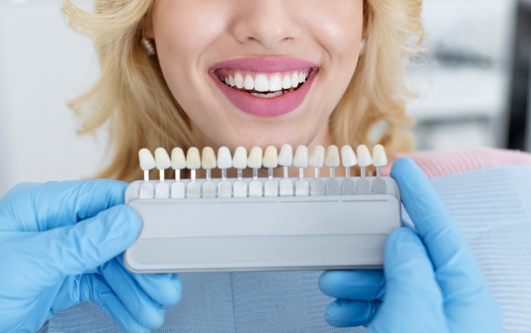 Guía de tonos dentales junto a la sonrisa de la paciente, en primer plano, en un tratamiento de Carillas dentales de Clínica Malai en Bilbao