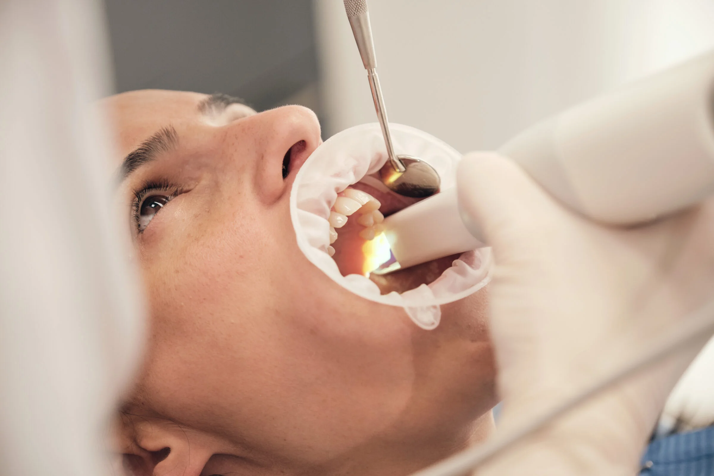Odontología en Bilbao: paciente durante una exploración dental con el equipo de la consulta