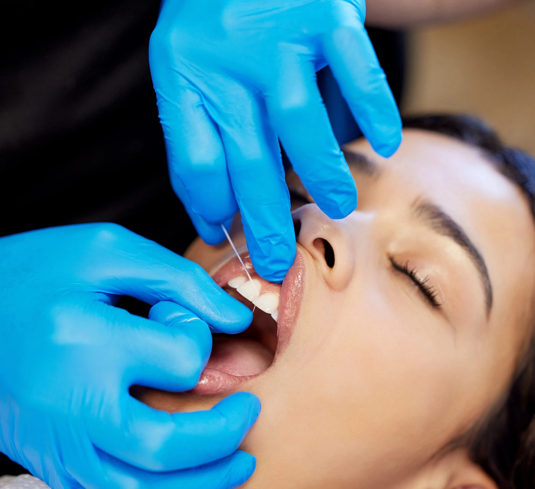 Odontología en Bilbao: profesional realizando una limpieza dental a una paciente