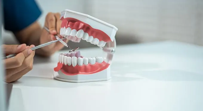 Estética dental en Bilbao: modelo dental de estudio sobre una mesa