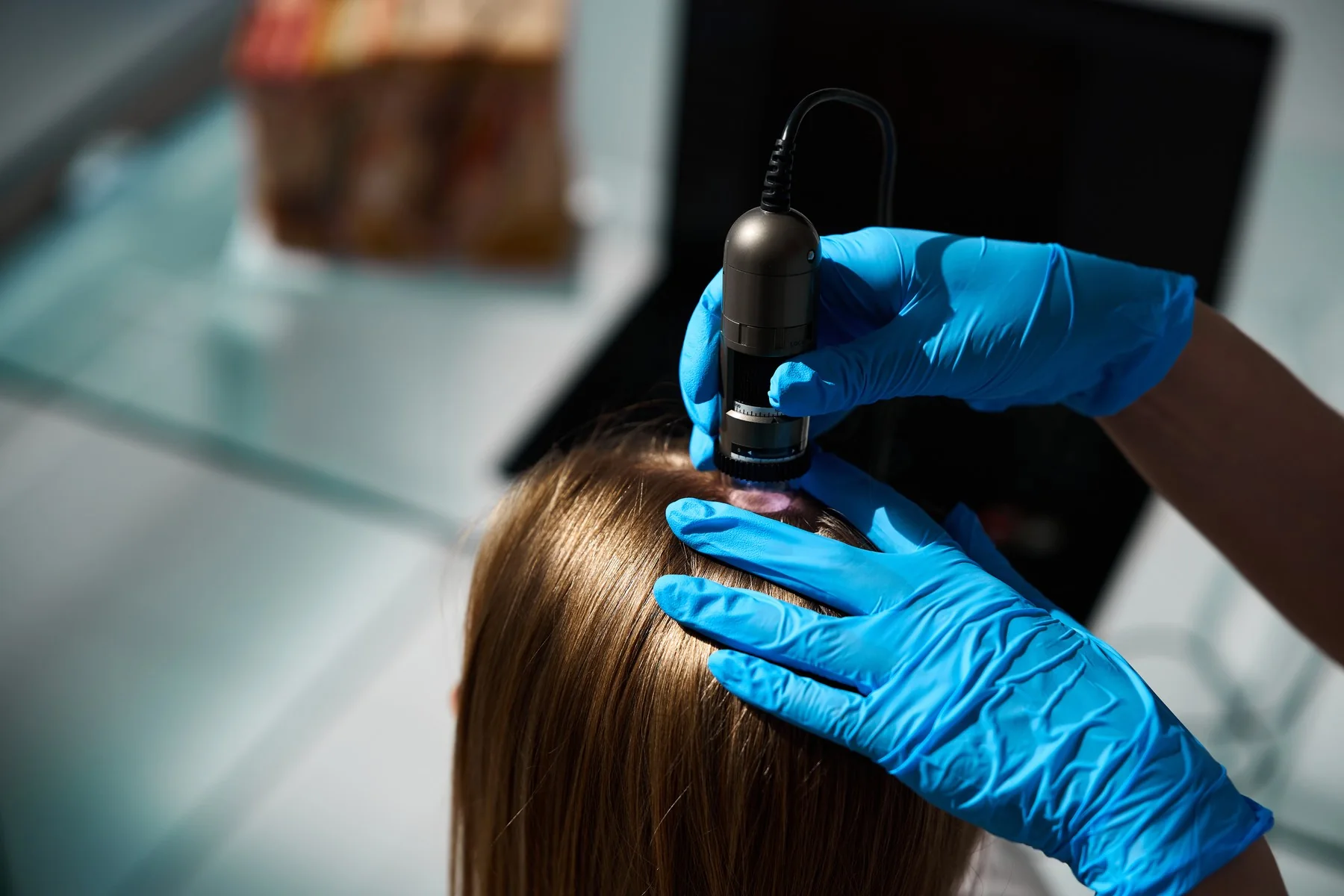 Medicina capilar en Bilbao: diagnóstico capilar con dermatoscopio digital en consulta