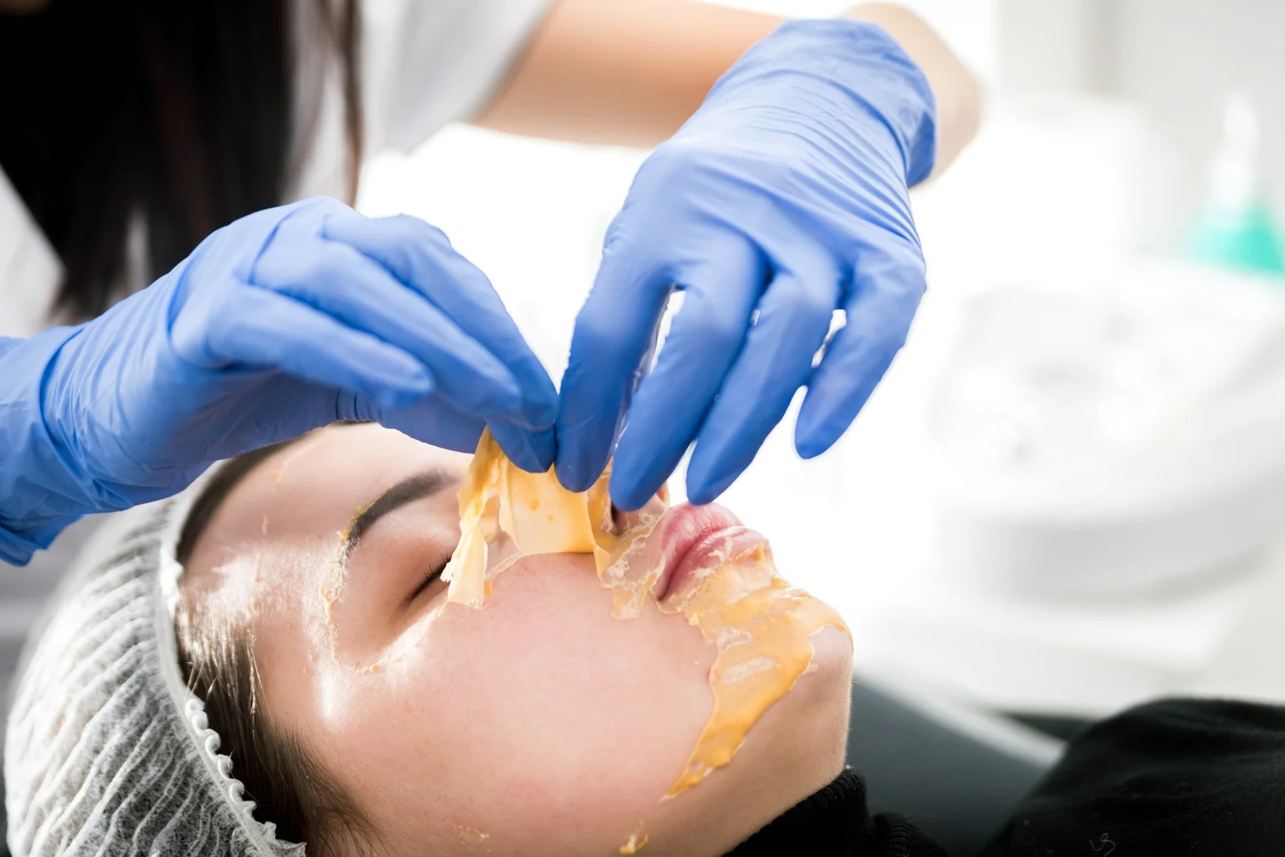 Retirada del preparado facial en la clínica, en un tratamiento de Peeling de fenol de Clínica Malai en Bilbao
