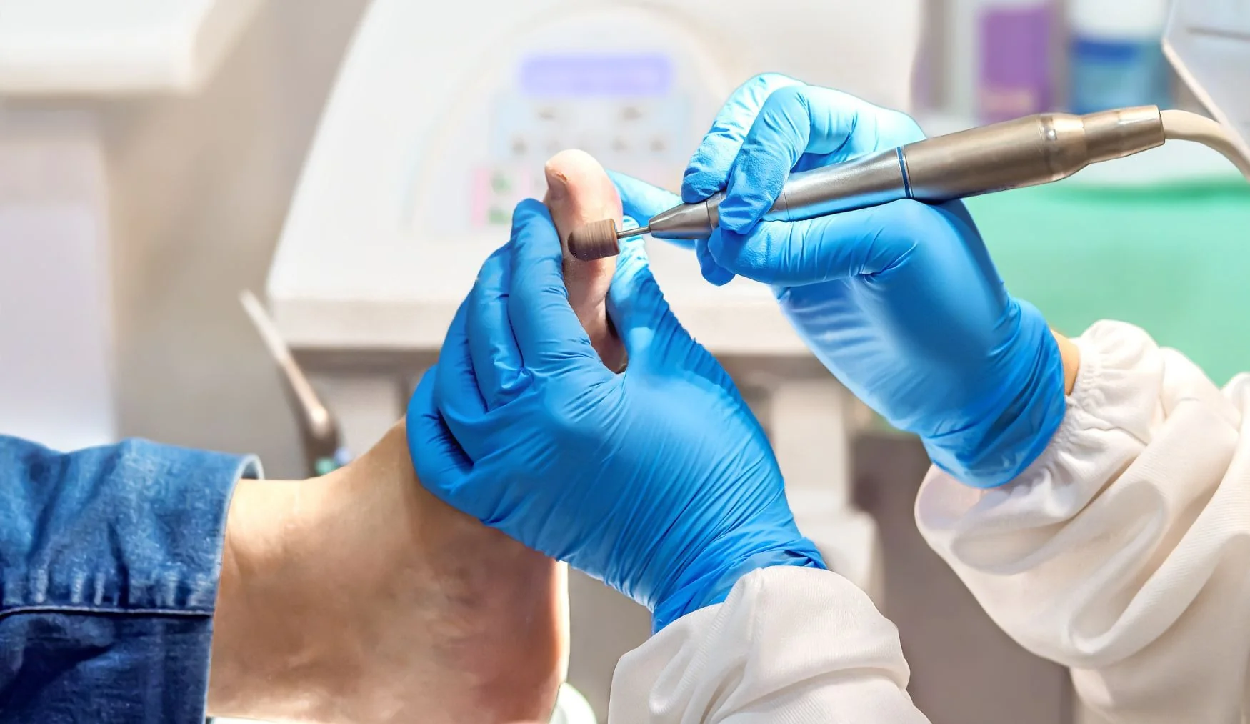 Quiropodia en Bilbao y Mungia: tratamiento de durezas y helomas en la consulta de podología