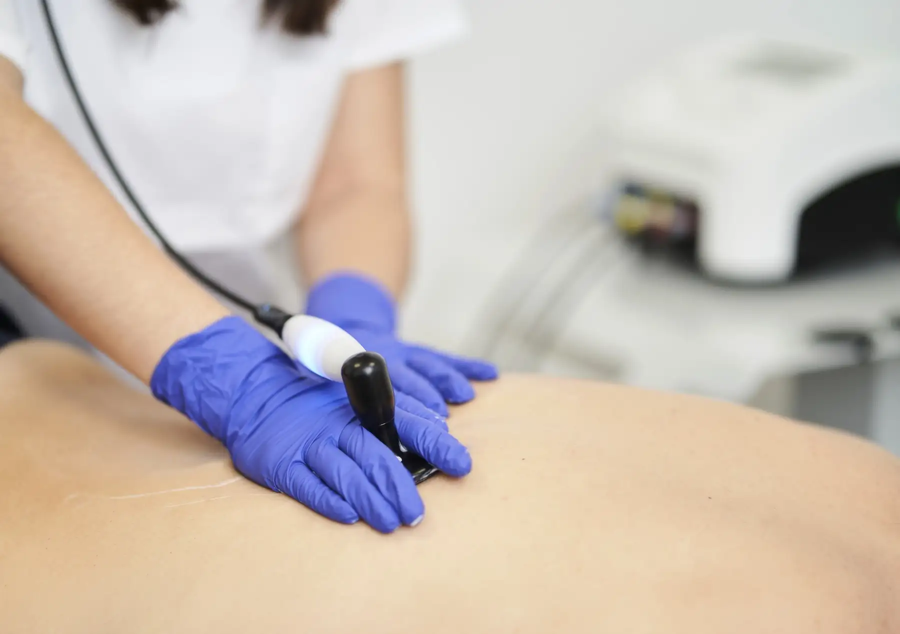 Radiofrecuencia y diatermia (Indiba) en Bilbao y Mungia: aplicación del cabezal sobre la zona lesionada durante la sesión