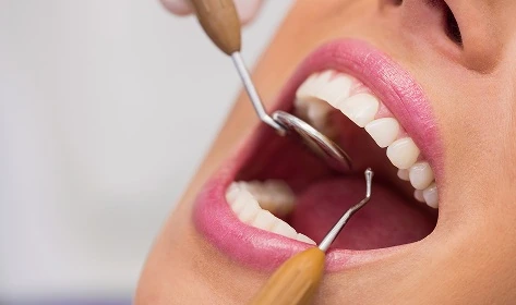 Odontología en Bilbao: revisión odontológica
