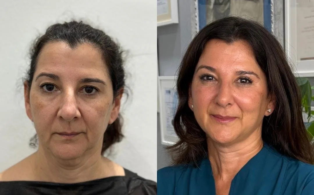 Estilo de vida y optimización de la salud en Bilbao: antes y después de la Dra. Sandra Cabeza