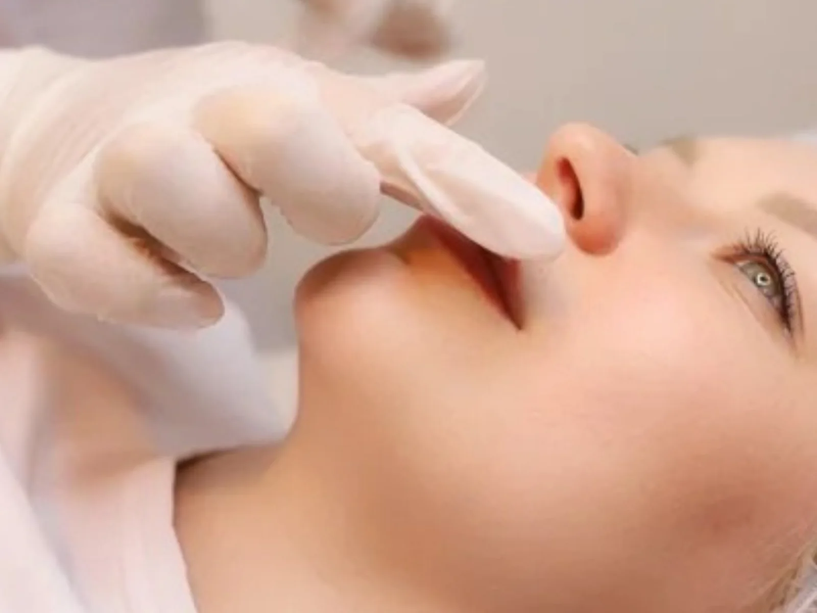 Liplift en Bilbao: médico valorando el labio superior de una paciente