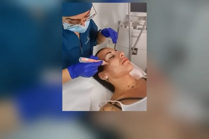 Exosomas en Bilbao: tratamiento facial con exosomas en Clínica Malai
