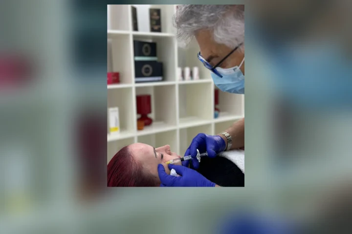 Polinucleótidos en Bilbao: el Dr. Nached infiltrando polinucleótidos en el rostro de una paciente